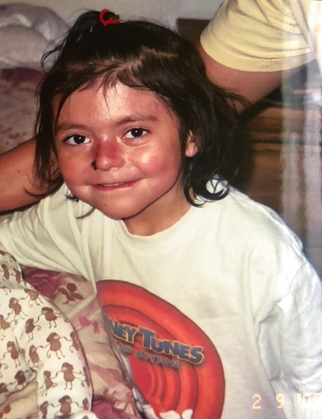 Co gai mac hoi chung lan da canh buom anh 2