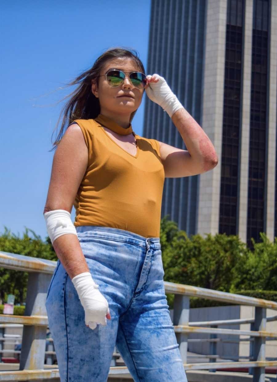 Co gai mac hoi chung lan da canh buom anh 6