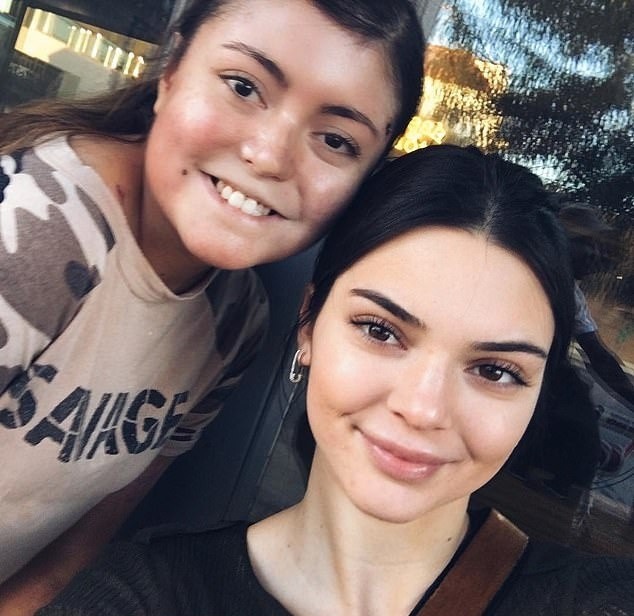 Co gai mac hoi chung lan da canh buom anh 9