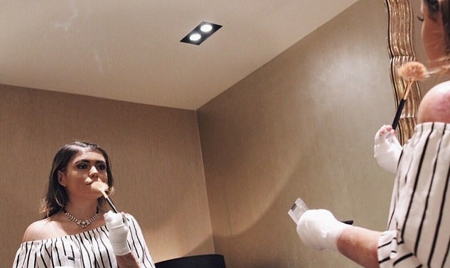 Co gai mac hoi chung lan da canh buom anh 11