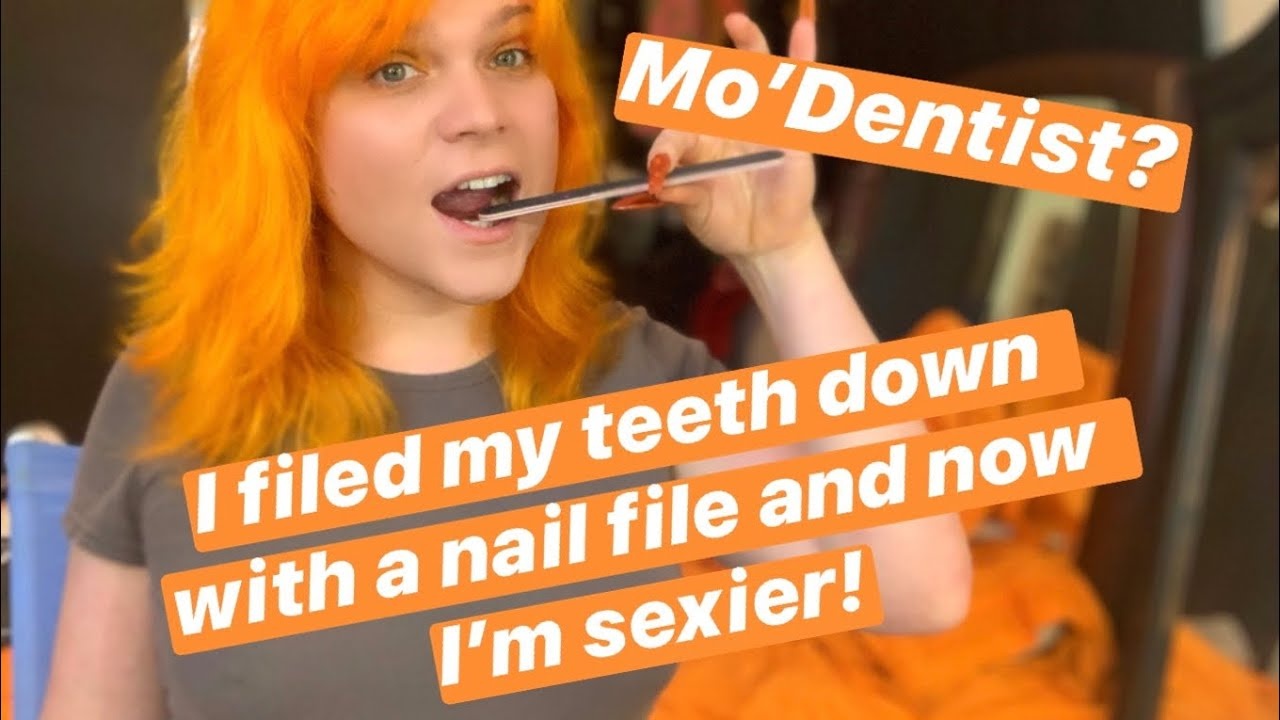 Xu huong mai rang bang dua mong tay tren TikTok anh 2