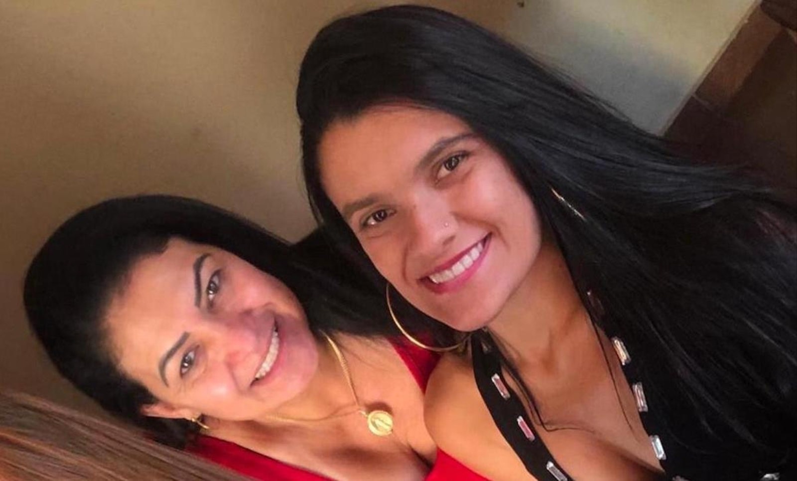 Co gai duoc tach roi tu nguoi chi song sinh uoc mo tro thanh bac si anh 2