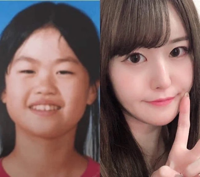 phau thuat tham my anh 1