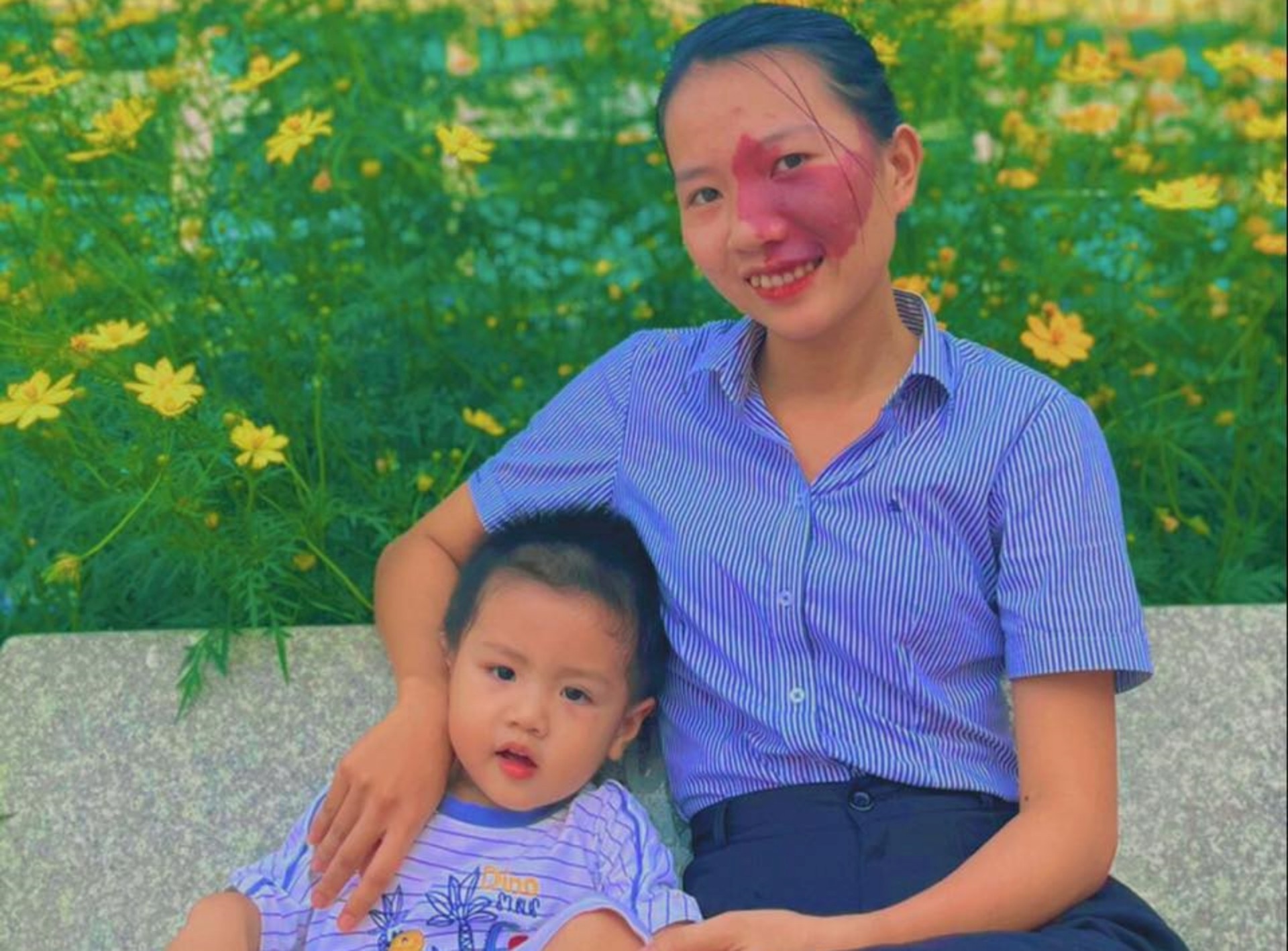 cô giáo có vết bớt ảnh 2 co giao co vet bot anh 2