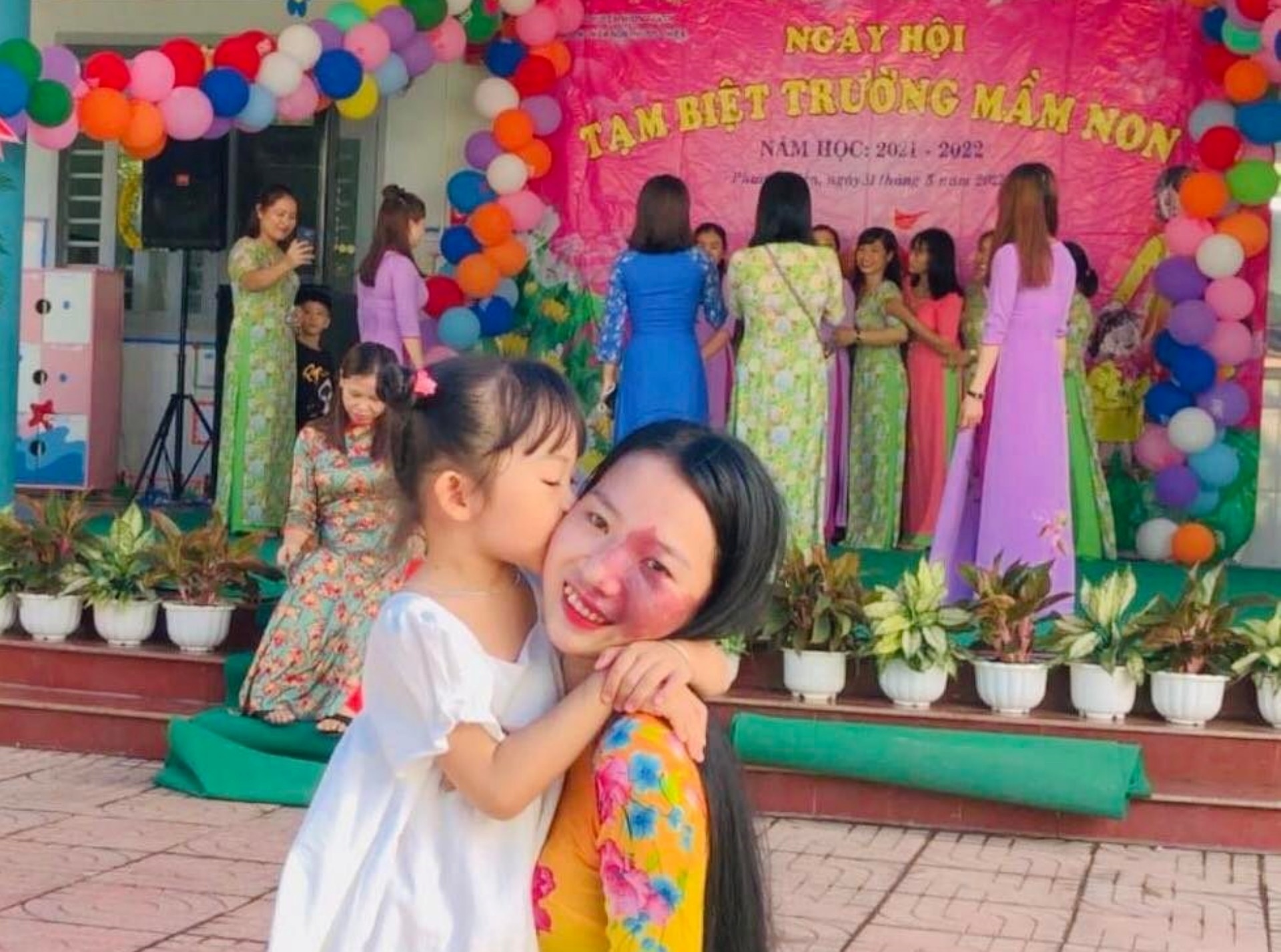 cô giáo có vết bớt ảnh 3 co giao co vet bot anh 3