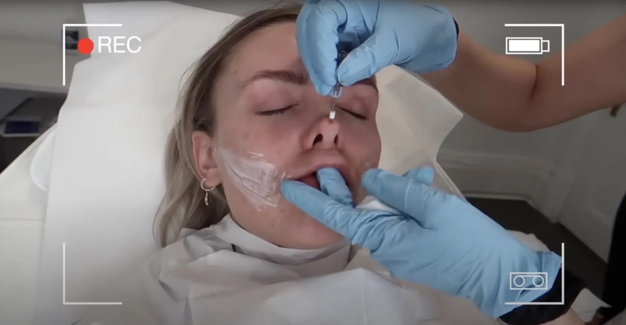 Phau thuat tham my anh 1