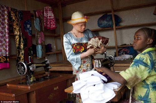 Người chủ cửa hàng chỉ lấy tiền mà không thèm nhìn mặt cô gái bị bạch tạng