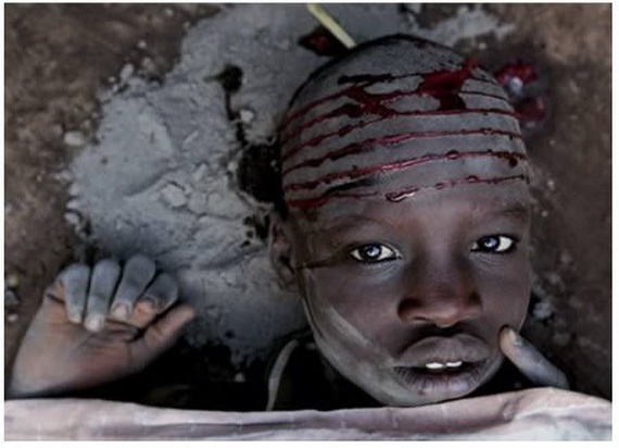 Những tập tục 'hãi hùng' làm biến dạng khuôn mặt con người (P1)