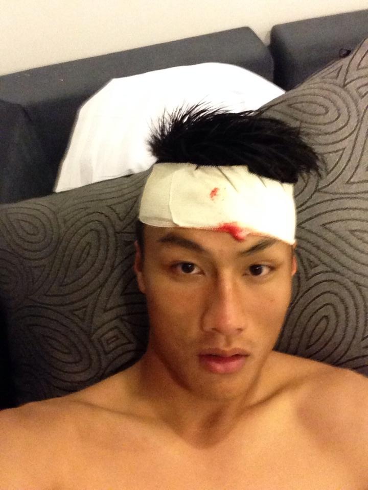 Bi CLB Indonesia choi xau, Hong Quan nhap vien khau 4 mui hinh anh