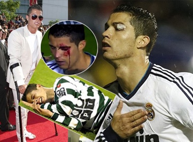 Cu soc dot quy, suyt bo mang tren san cua Ronaldo hinh anh