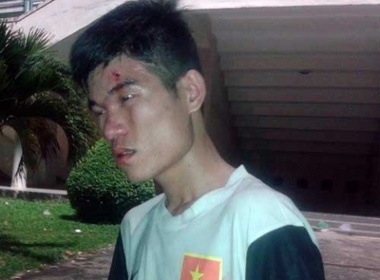 'Fan SLNA bi danh' viet don kien nghi len Cong an Binh Duong hinh anh