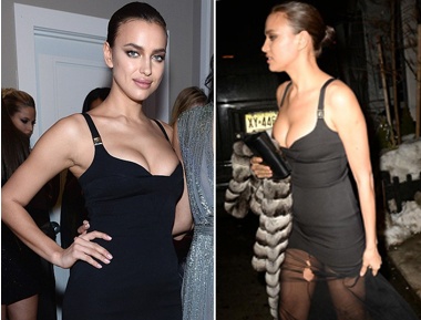 Irina mac vay rach, lo bung bau? hinh anh