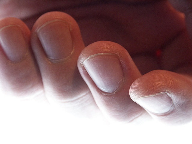 Ngon tay cut moc lai nho bang quang lon hinh anh