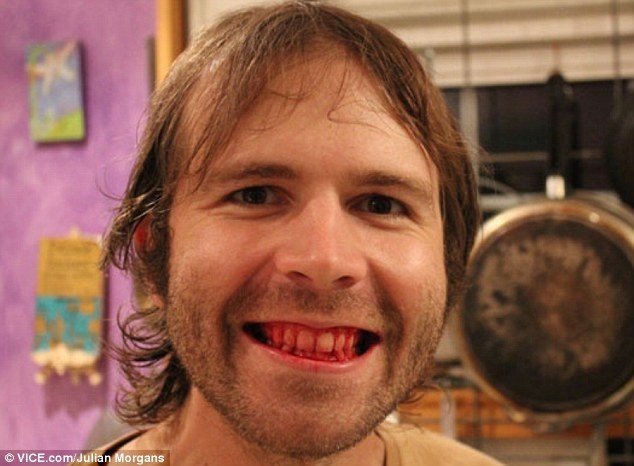 'Quai nhan' thich an thit song va uong mau tuoi hinh anh