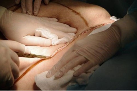 Linh My dua nhau hut mo bung hinh anh