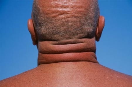 Kich thuoc co tiet lo kha nang chan goi cua phai manh hinh anh