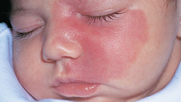 10 benh ky la cua con nguoi (ky 1) hinh anh