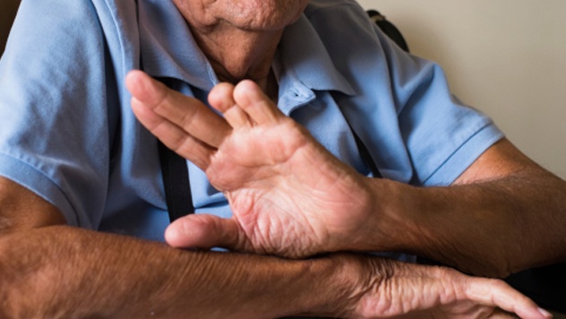 10 benh ky la cua con nguoi (ky 2) hinh anh