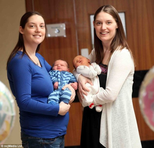 Nhung trung hop ky la cua cap song sinh hinh anh