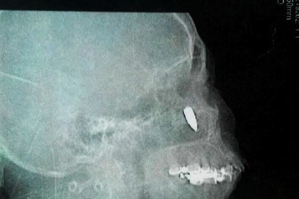 48 nam chung song cung vien dan trong hoc mui hinh anh