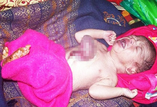 Be trai An Do gianh giat su song vi tim nam ngoai nguc hinh anh