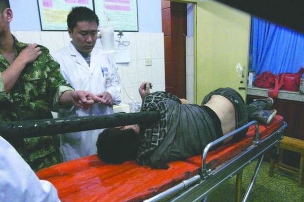 Các bác sĩ đang chữa trị cho nạn nhân Li. Ảnh: Mirror