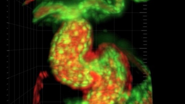 Video: Trai tim dap binh thuong cua mot phoi thai ca ngua 2 ngay tuoi hinh anh