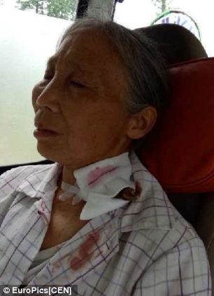 Di bo 11 km toi benh vien sau khi canh cay dam vao co hinh anh