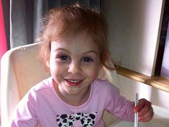 Duoi mot be gai ra khoi cua hang vi nhung vet seo hinh anh