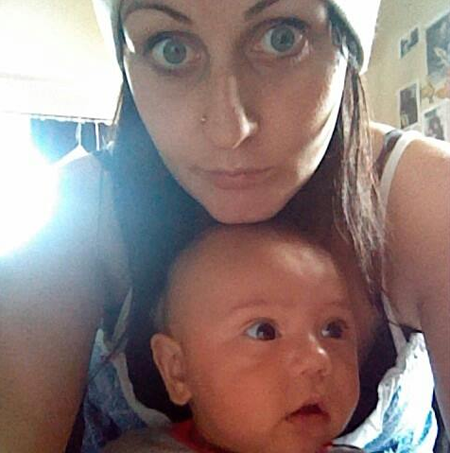 Phat hien thai khi phau thuat de cat buong trung hinh anh