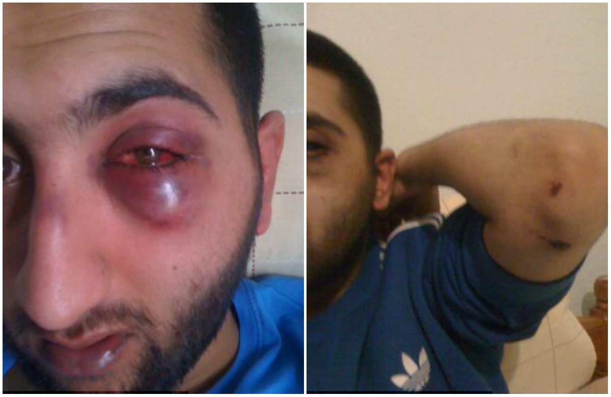 Video canh sat danh tai xe sung hoc mat hinh anh