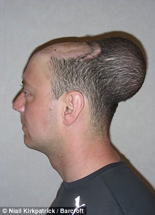 Bong nam trong dau nguoi dan ong hoi hinh anh