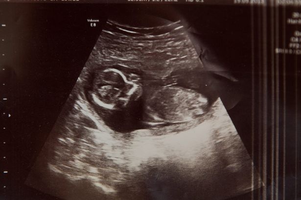 Me pha thai, con trong bung van song hinh anh