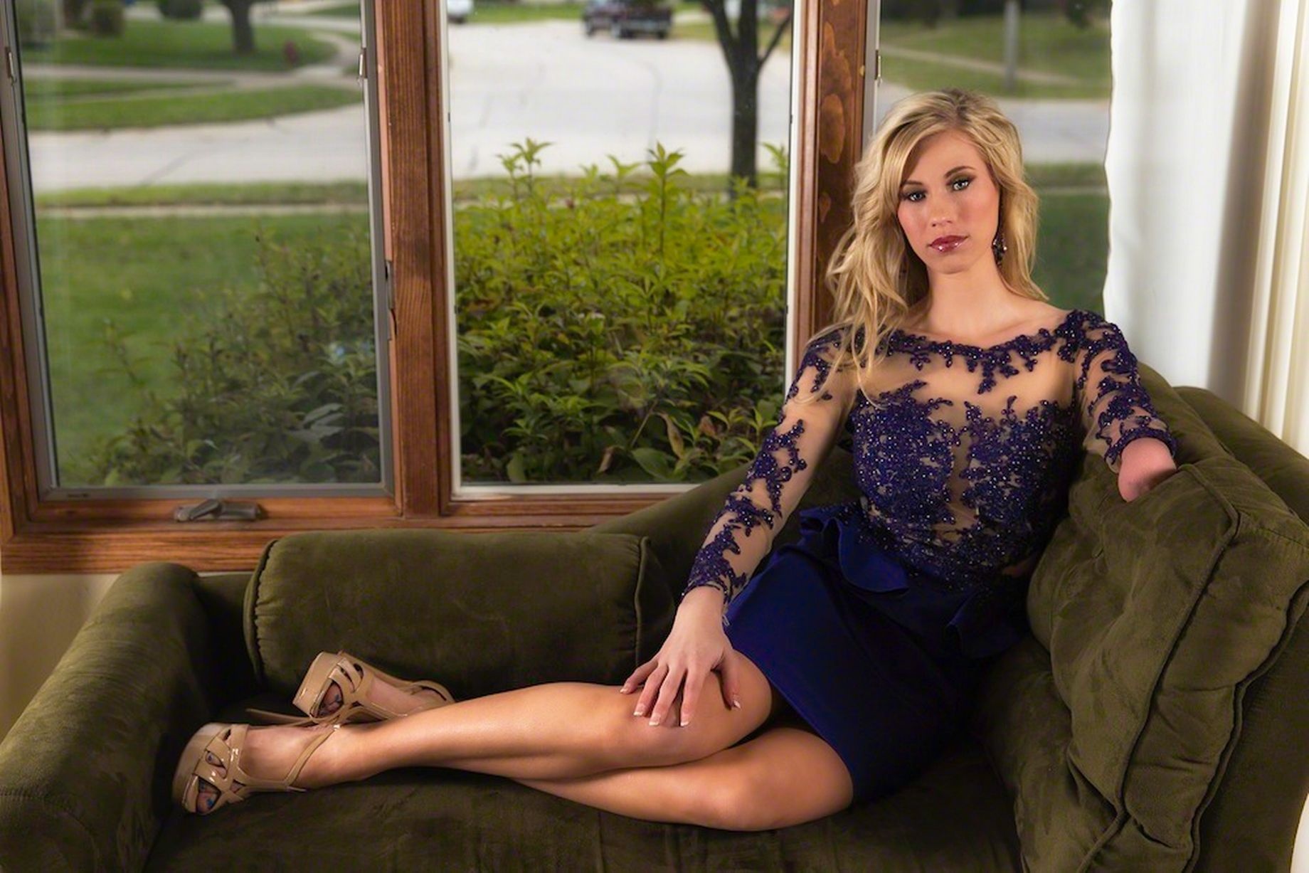 Sau khi giành chiến thắng trong cuộc thi sắc đẹp, nữ hoàng sắc đẹp một tay đã  truyền “lửa” cho giới trẻ, khuyến khích họ theo đuổi ước mơ, và giúp những người khuyết tật nâng cao nhận thức về cơ thể kém may mắn của họ.  Ảnh: Barcroft