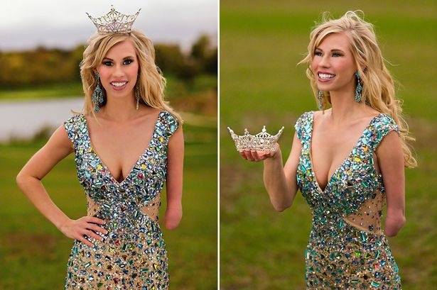 Cuoc doi co gai mat tay gianh vuong mien Hoa hau hinh anh