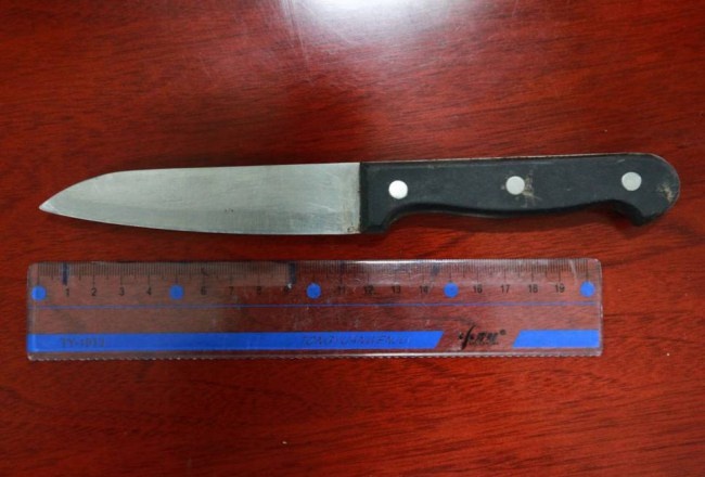 Con dao dài 11 cm cắm vào đầu Liu Yanya, 57 tuổi. Ảnh: Metro