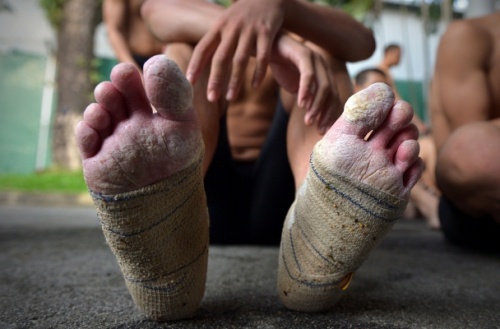 Thương tích là điều không thể tránh. 