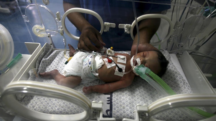 Mo cuu be gai trong bung me chet vi trung bom hinh anh