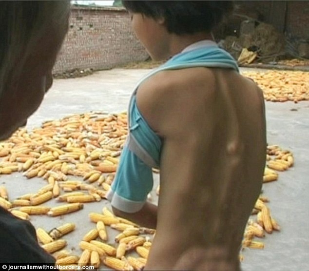 Co the cua be gai Trung Quoc bien dang vi chung hoa da hinh anh