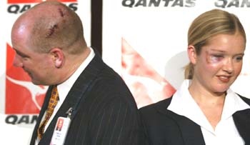 Tiếp viên Denise Hickson và Greg Khan bị thương khi khống chế một tên không tặc. Ảnh: SMH