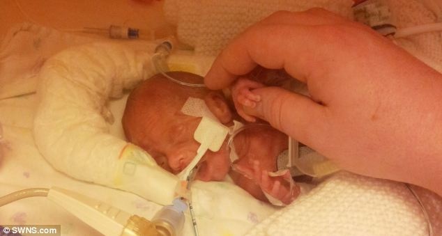 Ban nang sinh ton phi thuong cua em be nho bang dien thoai hinh anh