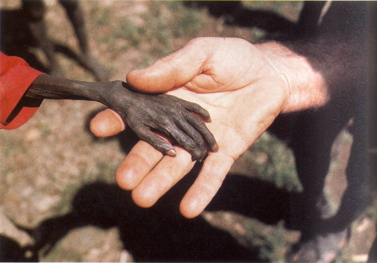 Bức hình của nhiếp ảnh gia Mike Wells chụp cánh tay cậu bé chết đói đặt trên bàn tay của một nhà truyền giáo ở Uganda năm 1980. 