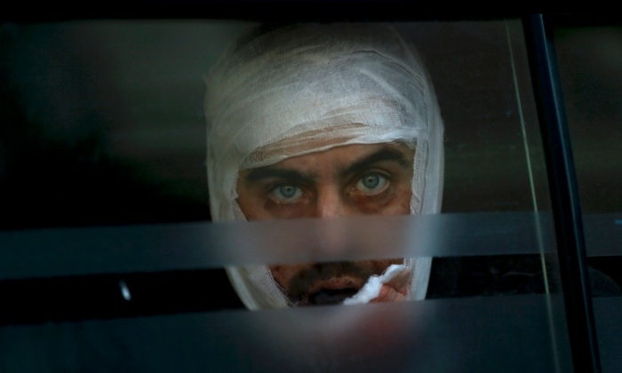 Một binh sĩ của quân đội Ukraine di chuyển tới bệnh viện ở Artemivsk để chữa trị vết thương. 