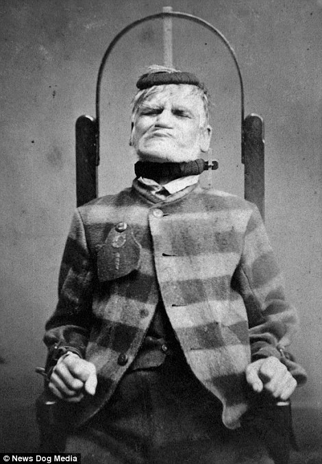 Các bác sĩ tại bệnh viện tâm thần dành cho người nghèo West Riding, hạt Yorkshire, điều trị cho bệnh nhân bằng cách trói ông vào ghế, cố định phần đầu bằng khung sắt. Người sáng lập bệnh viện tâm thần là nhà thần kinh học Sir James Crichton-Browne, theo báo Daily Mail.