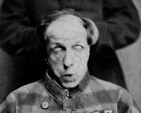 Các bác sĩ bắt cụ ông ngồi vào ghế. Bệnh viện tâm thần West Riding là một trong 6 nhà thương điên ở Anh vào thế kỷ 19. Nơi này đã điều trị cho hàng nghìn người tâm thần ở nước Anh.