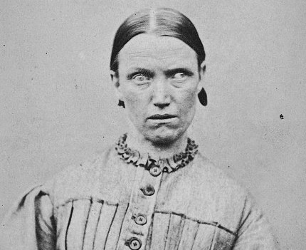 Các bác sĩ sử dụng nhiều hóa chất khác nhau tác động lên bộ não của bệnh nhân, như ma túy từ cây gai dầu, nicotin, rượu.