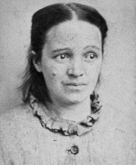 Một phụ nữ mắc chứng