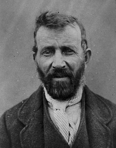 Bệnh nhân nam này mắc chứng