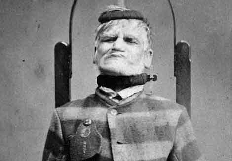 Nhung bien phap dieu tri tam than dang so o Anh the ky 19 hinh anh