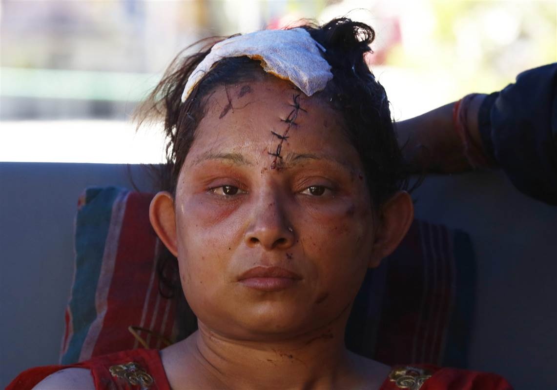 Một nạn nhân bị thương nặng sau trận động đất.